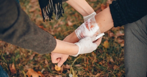 what to do if you suffer a burn injury at work